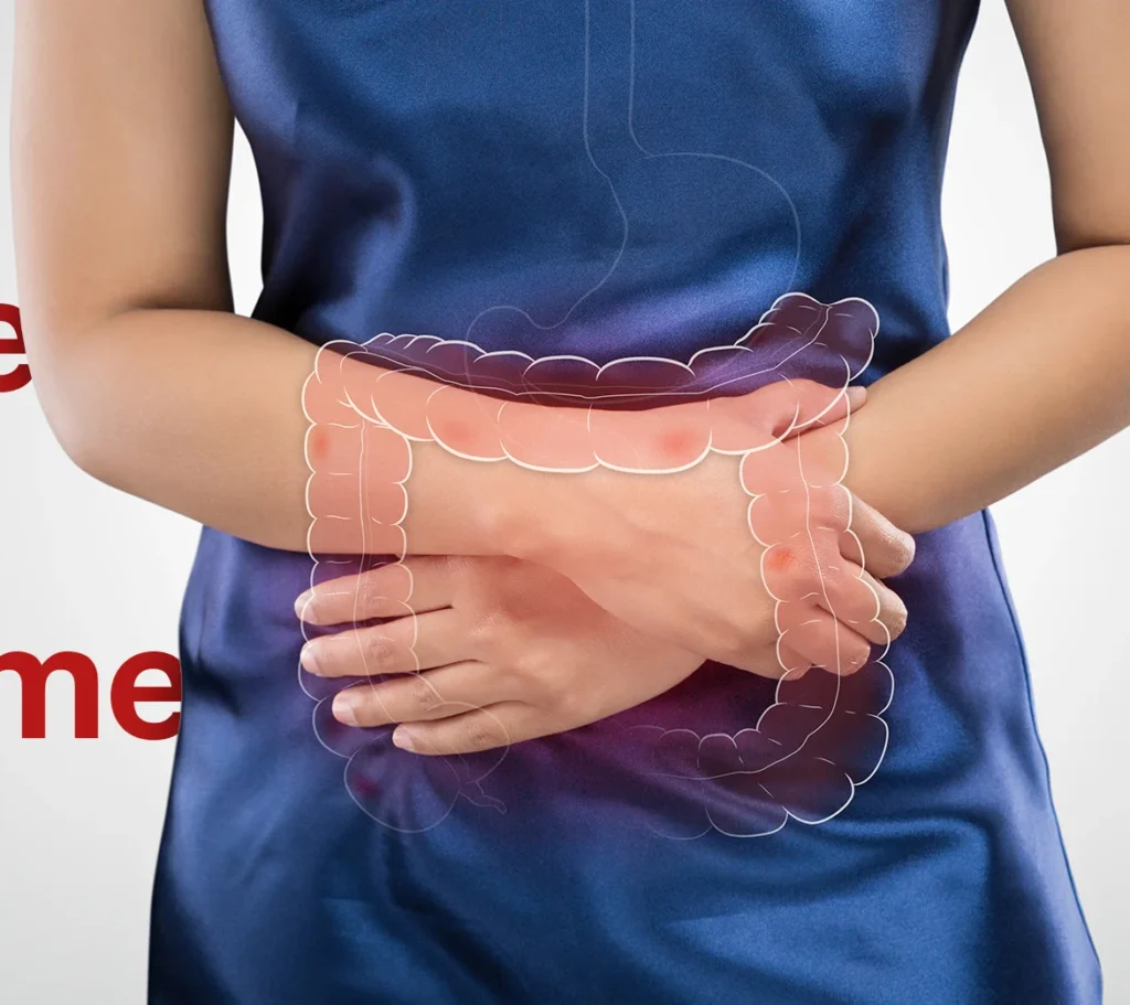 Treating IBS through Naturopathy